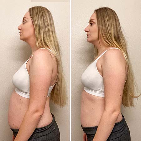SLENDERTONE UPDATE - 6 Month Results - Before & After Pics 